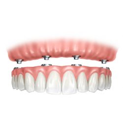 Protese dentaria odontologica Dottore-10
