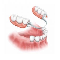 Protese dentaria odontologica Dottore-12